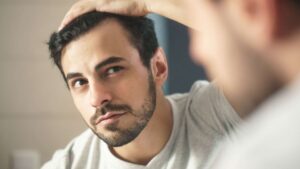 Hair loss: how does it happen and what can I do about it?