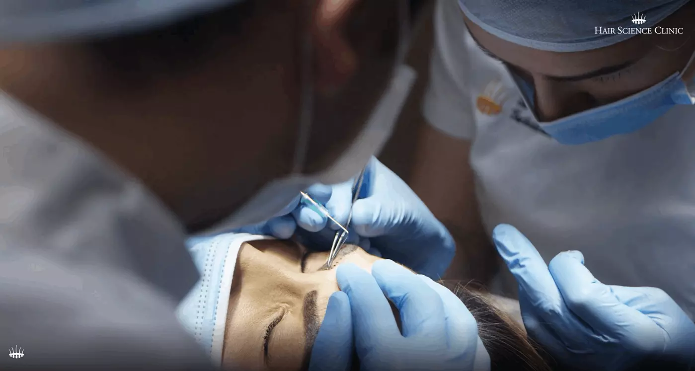 Eye brows transplantation